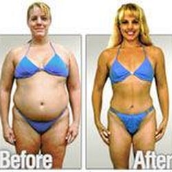 We have wonderful techniques for helping our patients lose the weight they desire. Ask Dr. Labrado for more information.