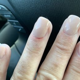 Cuticle nicked by the sanding tool. It's small but packs a punch when it happens. Cuticle nicked by the sanding tool. It's small but packs a punch when it happens.