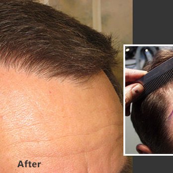 Timothy Carman, MD - La Jolla Hair Restoration - Yelp
