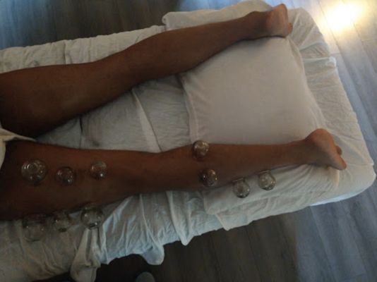 Cupping - Through services which include Acupuncture, Body Work, Injection Therapy, Herbal Medicine, Dietary and Nutritional Counseling, Cupping, and Gua sha, we hope to reduce suffering and improve the quality of life of our patients. At The Qi House, we always treat our patients as individuals, addressing their concerns calmly and with compassion. We look forward to your visit. Cupping - Through services which include Acupuncture, Body Work, Injection Therapy, Herbal Medicine, Dietary and Nutritional Counseling, Cupping, and Gua sha, we hope to reduce suffering and improve the quality of life of our patients. At The Qi House, we always treat our patients as individuals, addressing their concerns calmly and with compassion. We look forward to your visit.