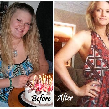 Epic Weight Loss Clinic - Before 220 lbs - After 125 lbs - Weight Loss Centers Near Me - Lantzville, British Columbia