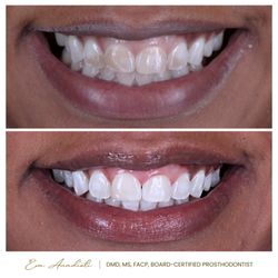 WELNOX Studio - Teeth Whitening