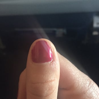 Royal Nails - Chipped and later infected nail - Nail Salons Near Me - San Antonio, Texas Royal Nails - Chipped and later infected nail - Nail Salons Near Me - San Antonio, Texas