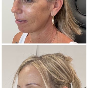 Livia Manner FNP - Medical Spas Near Me - Hollywood, Florida Livia Manner FNP - Medical Spas Near Me - Hollywood, Florida