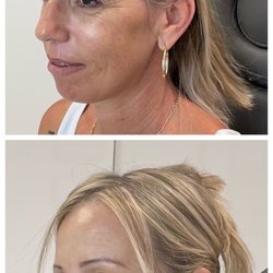 Aesthetic Excellence by Livia Manner, FNP