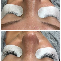Noralash - My before and after