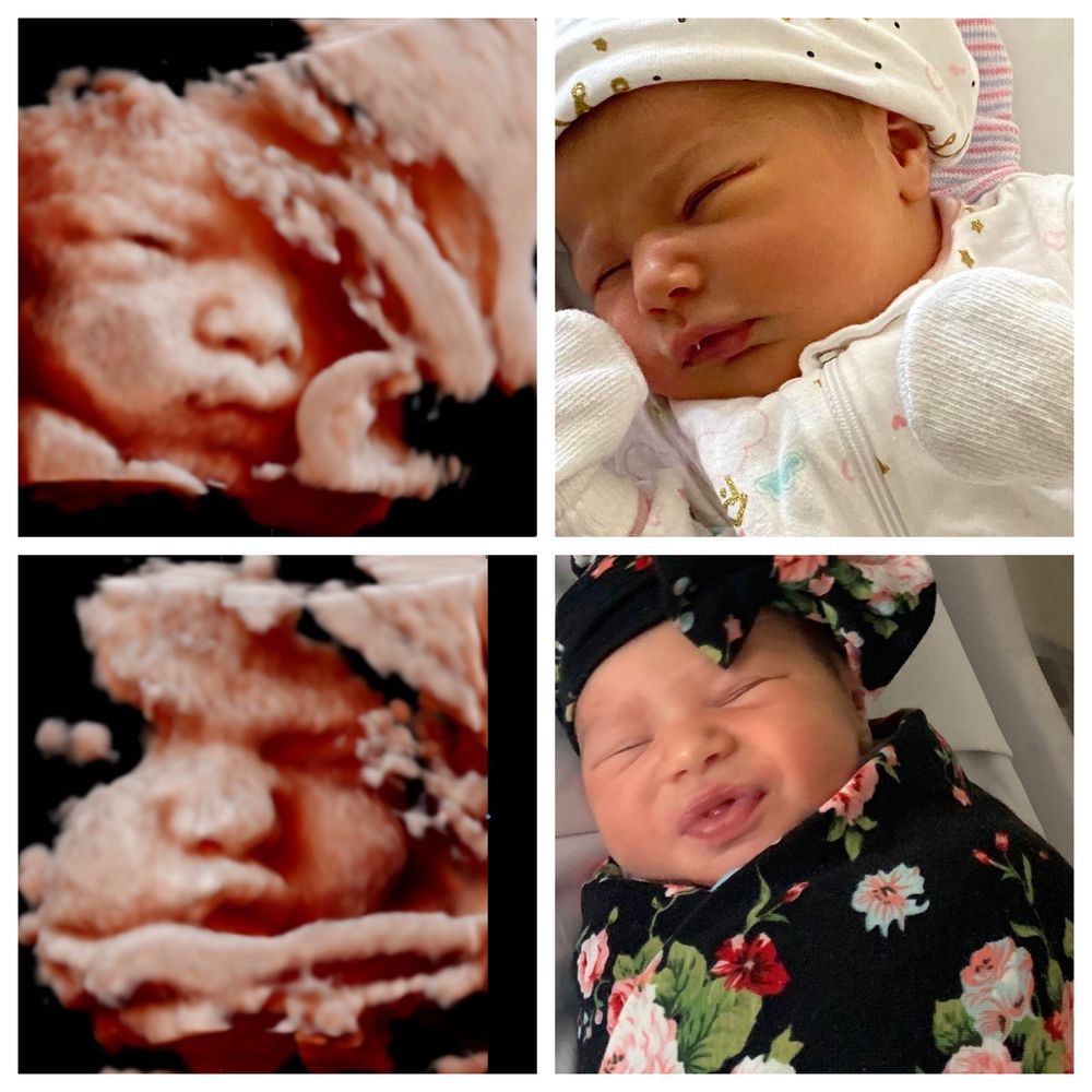 3d Ultrasound Union Nj edu.svet.gob.gt