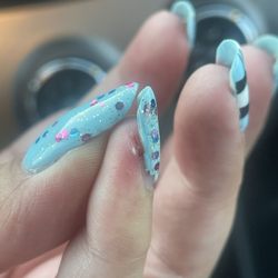 Combinations Luxury Nails & Spa - Deep cuts from aggressive filing.