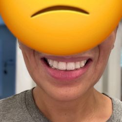 Lili & Associates - Nov. 2023. I just want straight front teeth not curved