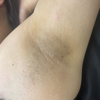 Beautify Me Bri - Underarm wax - Estheticians Near Me - Santa Clarita, California Beautify Me Bri - Underarm wax - Estheticians Near Me - Santa Clarita, California