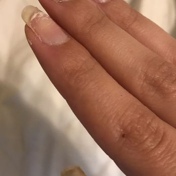 V & D Nails Spa - Nails I was sent home with. Nail was broken by employee Tina. - Nail Salons Near Me - Lawndale, California