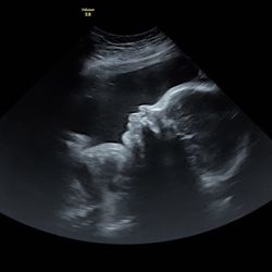 Little Buns Ultrasound & Baby Boutique - Cherish these snapshots as a beautiful reminder of the precious moments during your pregnancy.