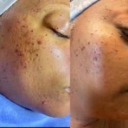 Beford and after of a clients transformation.