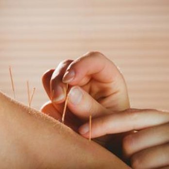 Yupeng Oriental Medicine - Acupuncture for improving several disorders - Acupuncture Near Me - Westford, Massachusetts Yupeng Oriental Medicine - Acupuncture for improving several disorders - Acupuncture Near Me - Westford, Massachusetts