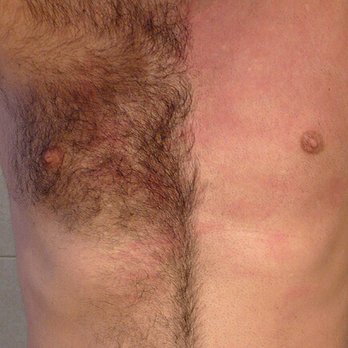 Mobile Waxing - Chest waxing - Waxing Near Me
