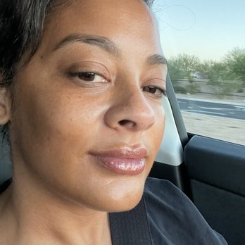 Kiss Me Vegas - So far they look amazing!! - Skin Care Near Me