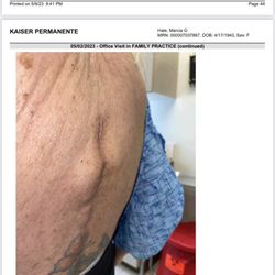 Kasra Rowshan, MD - Results of Dr Rowshan's surgery