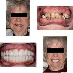 Mesa Dental Center