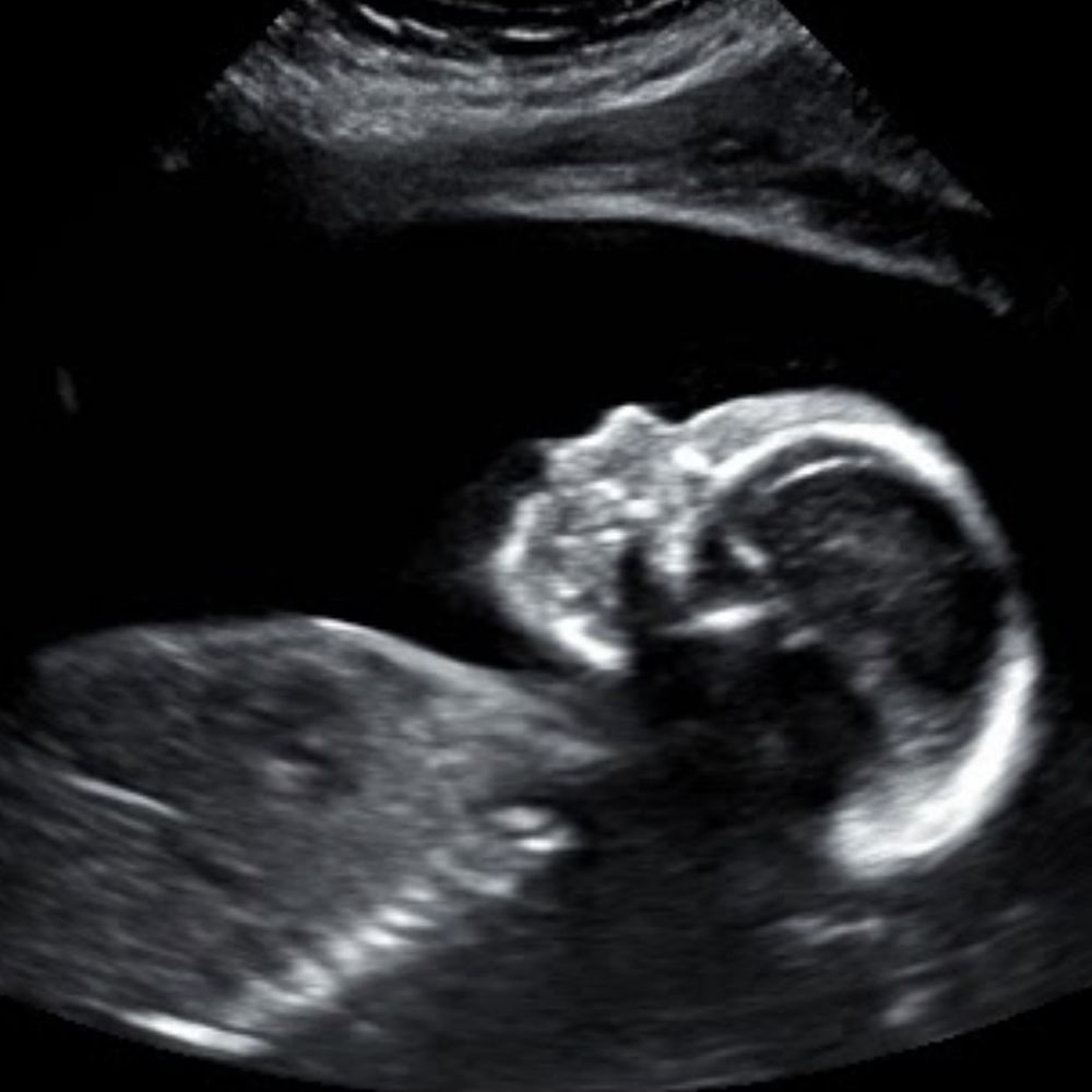 Womb in Bloom - One of my favorite pictures I received, at 23 weeks pregnant. - Diagnostic Imaging Near Me - Redding, California Womb in Bloom - One of my favorite pictures I received, at 23 weeks pregnant. - Diagnostic Imaging Near Me - Redding, California