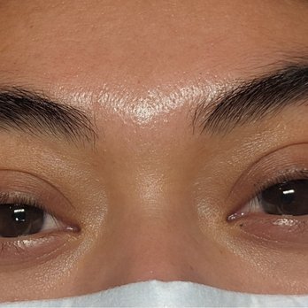 Peel Simply Skin - Skin Care Near Me - San Diego, California