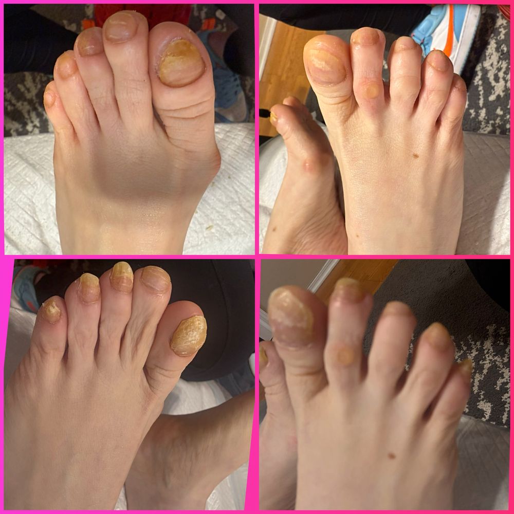 The Foot Care Nurse - home care agency in Springfield, MO