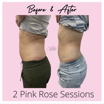 Pinkrose Dollhouse - Body Sculpting - Medical Spas Near Me - Elk Grove, California Pinkrose Dollhouse - Body Sculpting - Medical Spas Near Me - Elk Grove, California