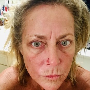 RevivaMed Plastic Surgery - taken oct 2020 - Medical Spas Near Me - San Diego, California