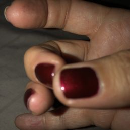 How short he cut my nails when asked to even out the lengths. How short he cut my nails when asked to even out the lengths.