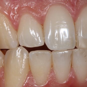 Antoine Sayegh, DDS - implantasmile - Cosmetic Dentists Near Me - Glendora, California