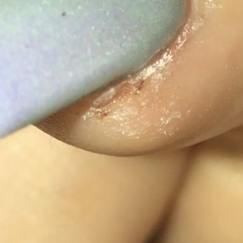 Fancy Nails - Cut cuticle. Hurt sooooo bad - Nail Salons Near Me - Irving, Texas Fancy Nails - Cut cuticle. Hurt sooooo bad - Nail Salons Near Me - Irving, Texas