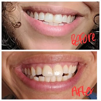 Advanced Smile Center - General Dentistry Near Me - Austin, Texas