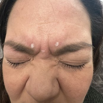 KQ Aesthetics - Skin Care Near Me KQ Aesthetics - Skin Care Near Me