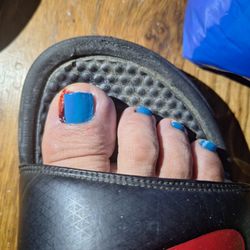 K Nails - Cuticle damage