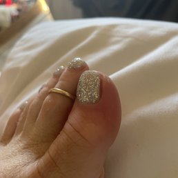 Day one of infection from nail technicians, lack of attention or concern or skill all the while she was on her phone texting.