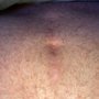 Photo of Bender Daniel H MD