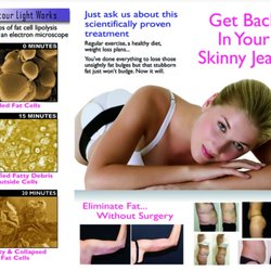 Ideal Body Image NW - How does Contour Light Work?