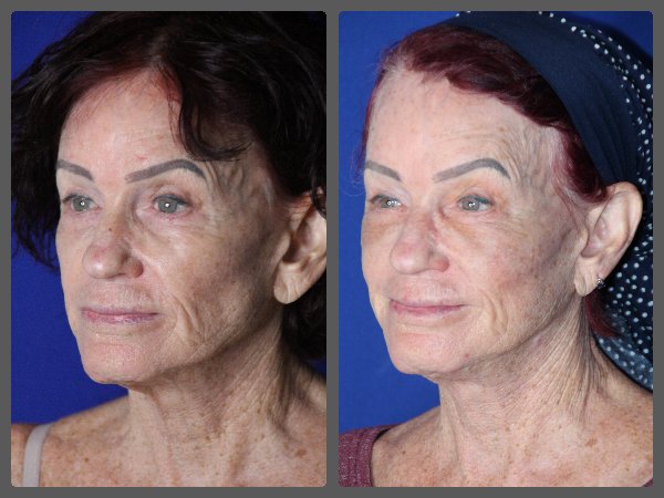 Beauty by Design - Dr Robert Troell Logo