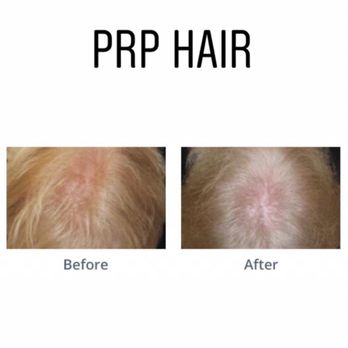 Premier Plastic Surgery - Cosmetic Surgeons Near Me - Pearland, Texas