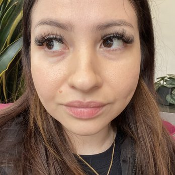 Be You Medical - Before filler under my eyes about half syringe - Medical Spas Near Me - Sacramento, California Be You Medical - Before filler under my eyes about half syringe - Medical Spas Near Me - Sacramento, California