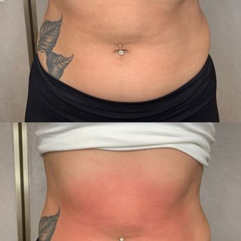 V Line Cosmetic Clinic - Venus Legacy - Skin Care Near Me - Arcadia, California V Line Cosmetic Clinic - Venus Legacy - Skin Care Near Me - Arcadia, California