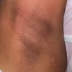 Divine Skin & More - Underarm wax