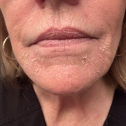 Great Skin Rules - Let the peeling begin!