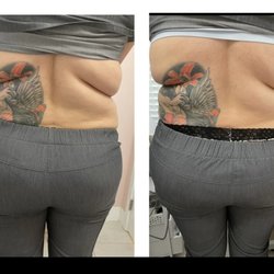 The Beauty Tender - Body Sculpting after 1 session