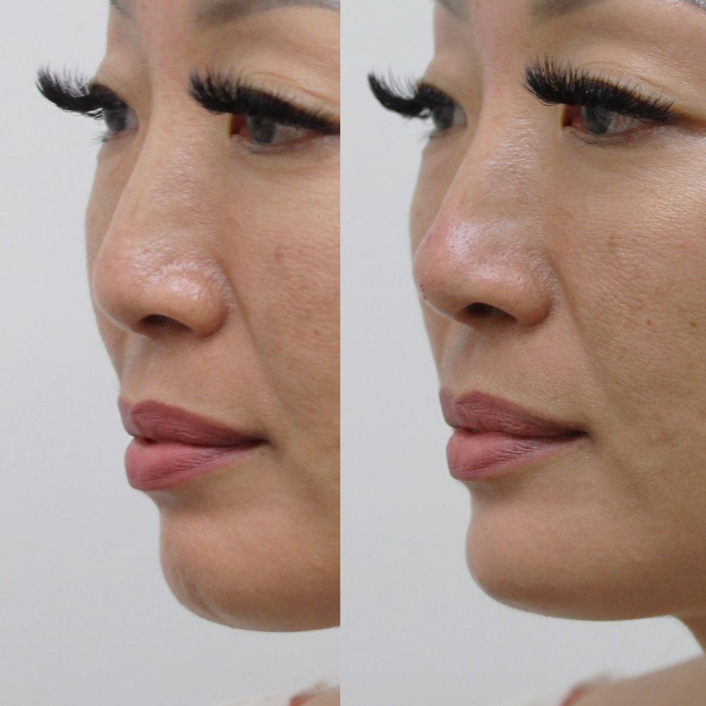 Melanie Tantisira M.D