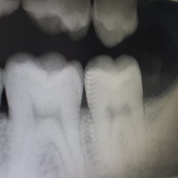 Winfield Family Dentistry - My teeth :) - General Dentistry Near Me - Winfield, Illinois