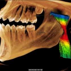 Darce A Slate, DDS - Pure Dentistry - State of the are evaluation of upper airway.