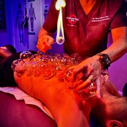 Acupuncture Zen - Dr. Tony Willcox is applying glass fire cupping to a patient's back at Acupuncture Zen in Delray Beach