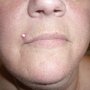 Photo of Skin Deep Piercing