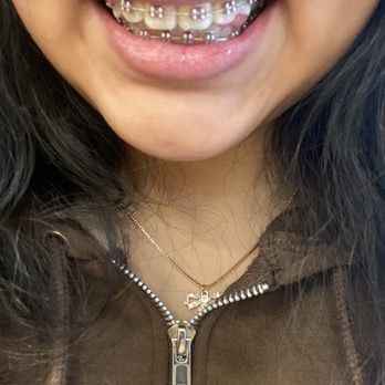Unique Orthodontics - My teeth - Orthodontists Near Me - Madera, California Unique Orthodontics - My teeth - Orthodontists Near Me - Madera, California