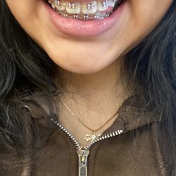 My teeth